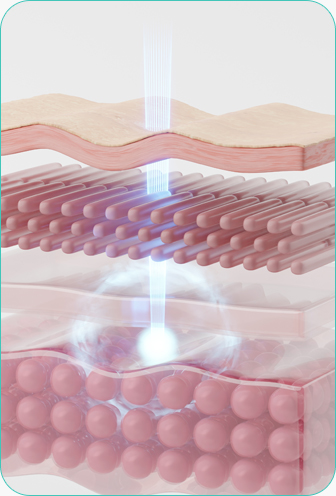 땡큐피부과 써마지 FLX