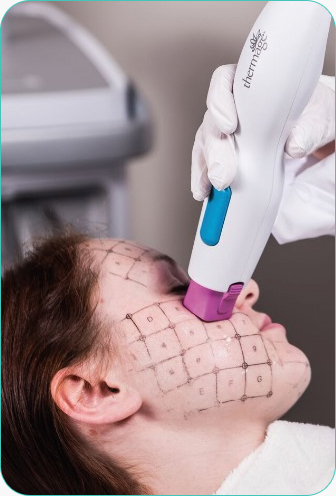 땡큐피부과 써마지 FLX