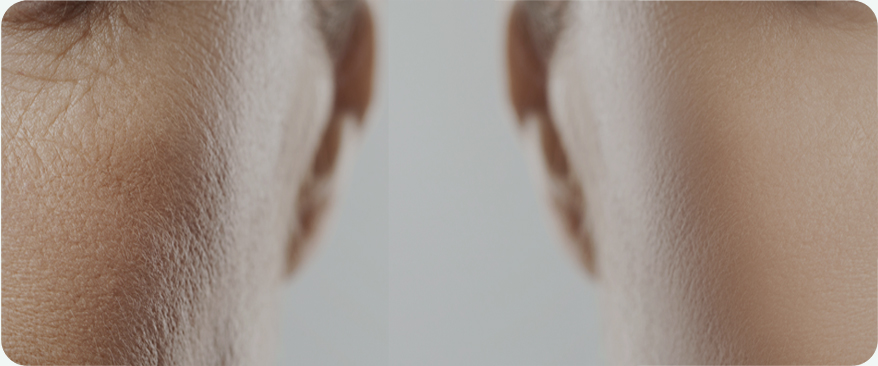 땡큐피부과 최적의 솔루션