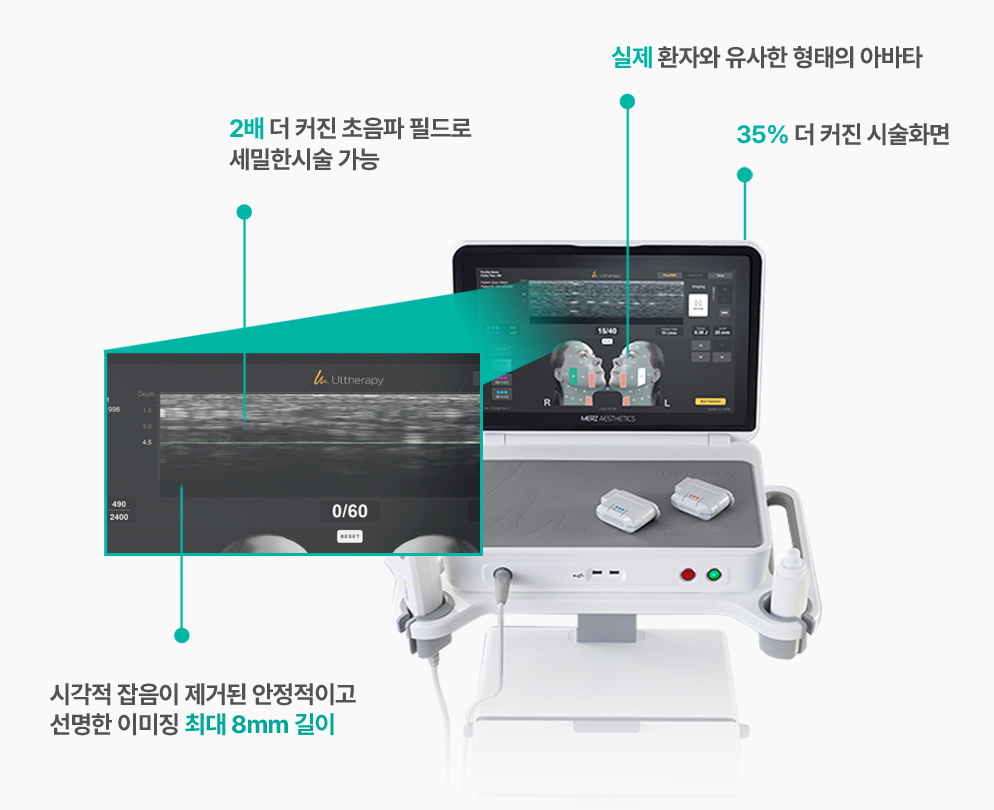 땡큐피부과 울쎄라프라임 스펙