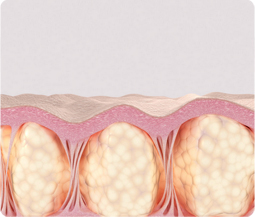 땡큐피부과 울쎄라프라임
