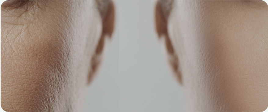 땡큐피부과 최적의 솔루션