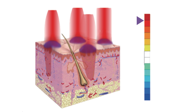 땡큐피부과 튠페이스