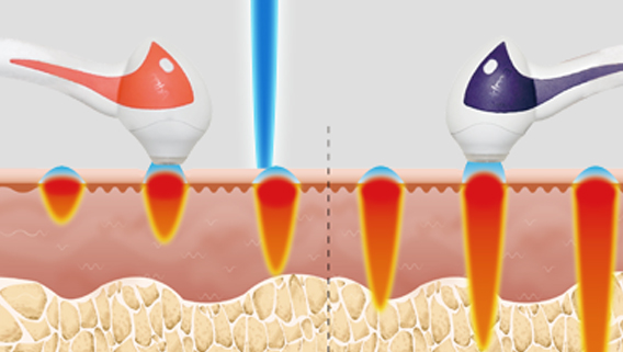 땡큐피부과 튠페이스