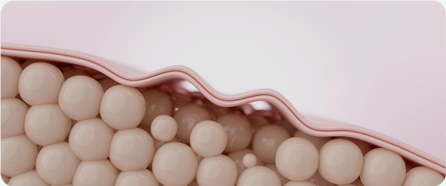 땡큐피부과 최적의 솔루션