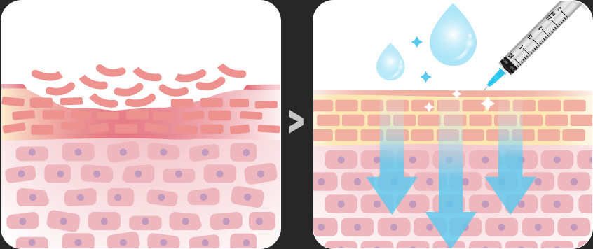 땡큐피부과 물광주사