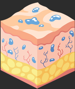 땡큐피부과 스컬트라 콜라겐 생성원리