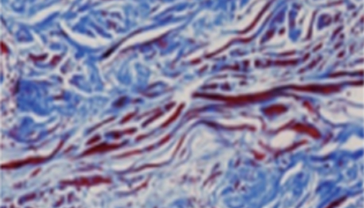 엘라비에 리투오