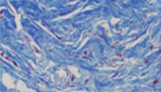 엘라비에 리투오