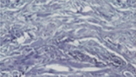 엘라비에 리투오