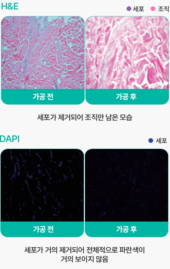 땡큐피부과 실리프팅