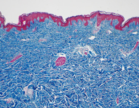 땡큐피부과 쥬브아셀