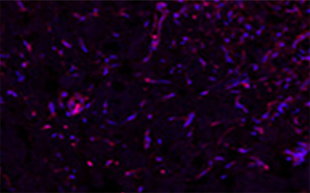 땡큐피부과 쥬브아셀