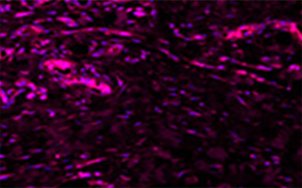땡큐피부과 쥬브아셀