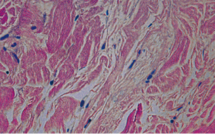 땡큐피부과 쥬브아셀