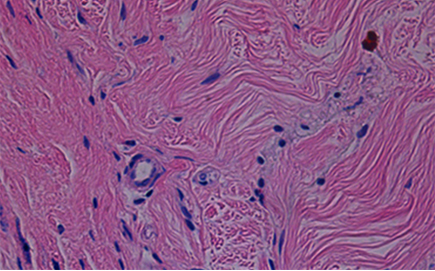 땡큐피부과 쥬브아셀