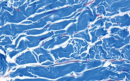 땡큐피부과 쥬브아셀