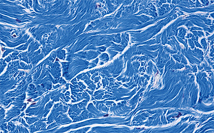 땡큐피부과 쥬브아셀