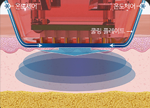 땡큐피부과 버츄RF