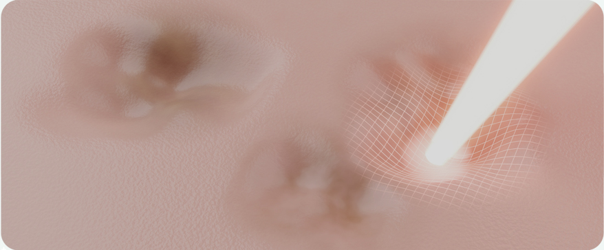 땡큐피부과 최적의 솔루션