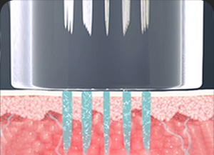 땡큐피부과 포텐자