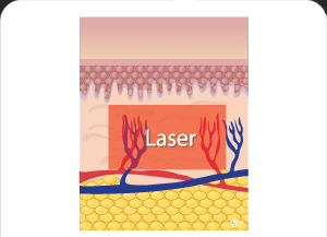 땡큐피부과 포텐자