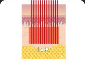 땡큐피부과 포텐자
