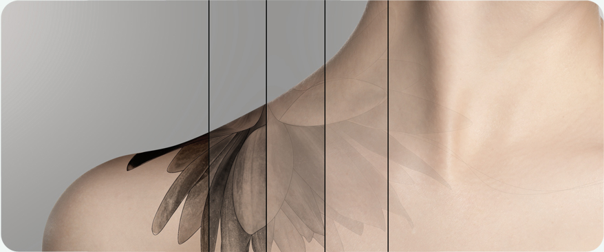 땡큐피부과 최적의 솔루션