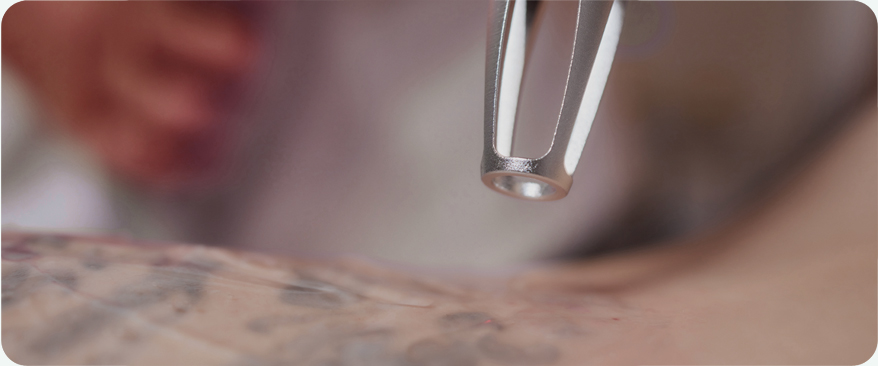 땡큐피부과 최적의 솔루션