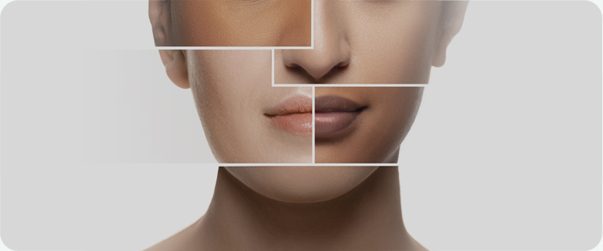 땡큐피부과 최적의 솔루션