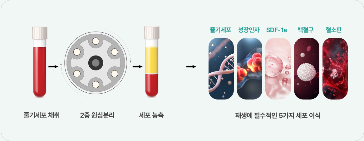 땡큐피부과 자가혈 스킨부스터  PROCESS