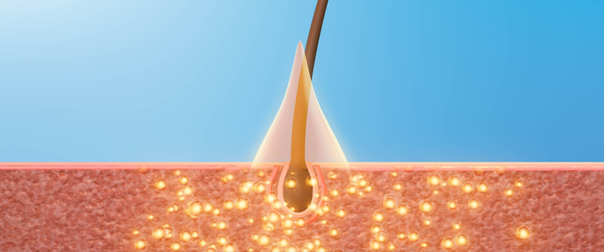 맞춤형 치료 계획