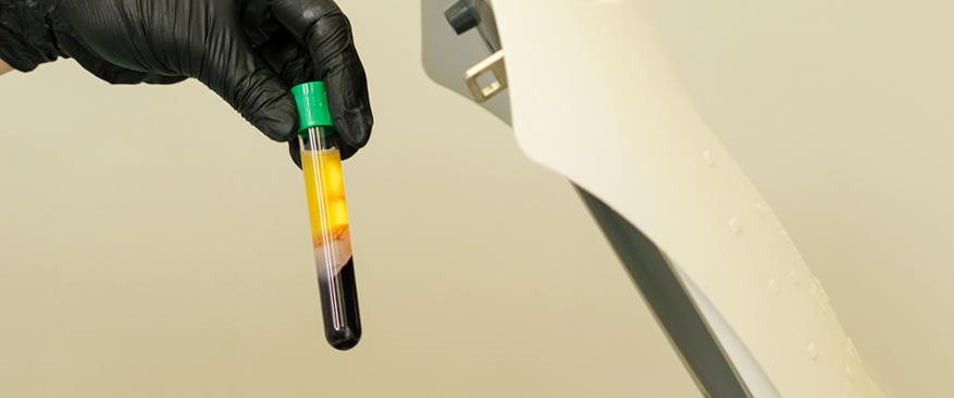 안전한 줄기세포 추출 및 분리