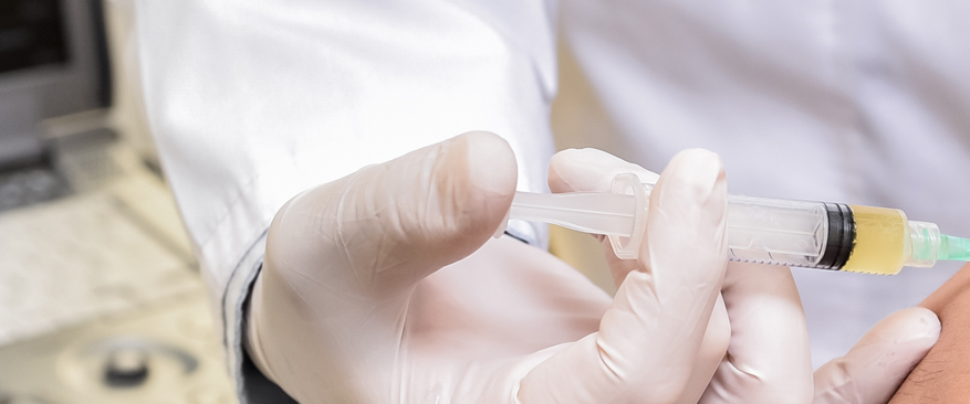 고농축 자가 줄기세포