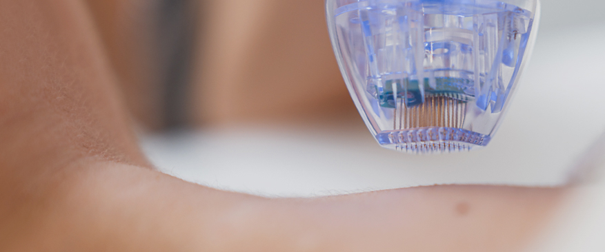 체계적인 사후 관리